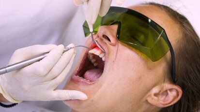 El uso del láser en Periodoncia (6)