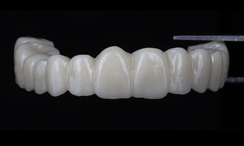 Fig. 34