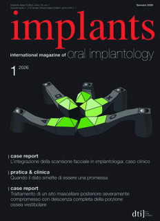 implants Italy No. 1, 2026