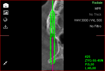 Fig. 25c