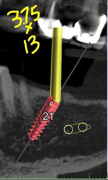 Fig. 5e