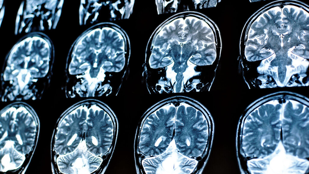 New evidence suggests possible link between brain function and oral health