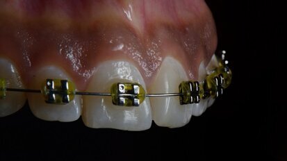 Dental photography school releases India's first dental calendar