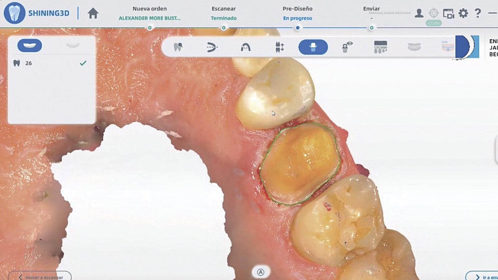Estética y blanqueamiento dental en la era digital  (Capítulo 21)