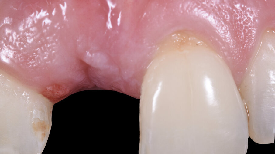 Fig. 7