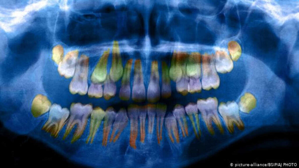 Os níveis de estresse são refletidos nos dentes