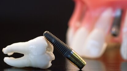 Proste i zaawansowane sposoby leczenia periimplantitis