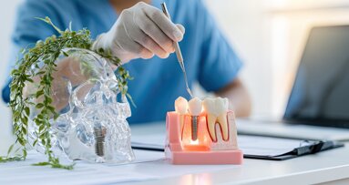 “Understanding patterns of peri-implant bacterial colonisation is fundamental to preventing progression to peri-implant mucositis”