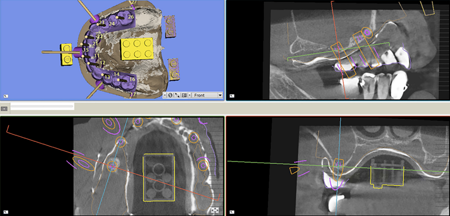 Fig. 6