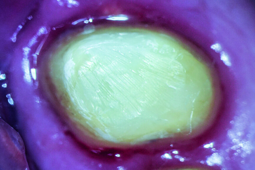 Fig.: 15