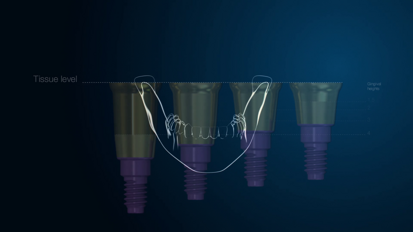 MIS CONNECT System