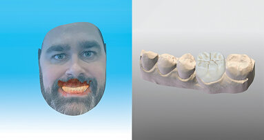 Dental Wings anuncia o lançamento de principais atualizações de software