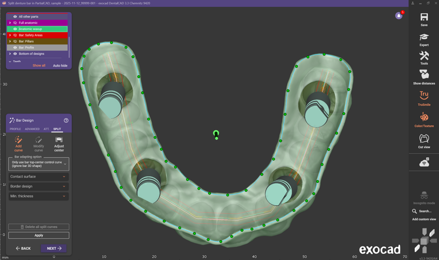 Fig. 3: Add/modify split curve.