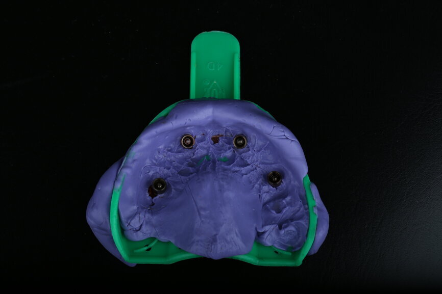 Fig. 56
