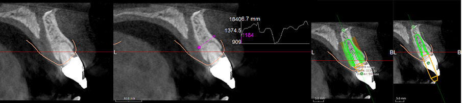 Fig. 10c