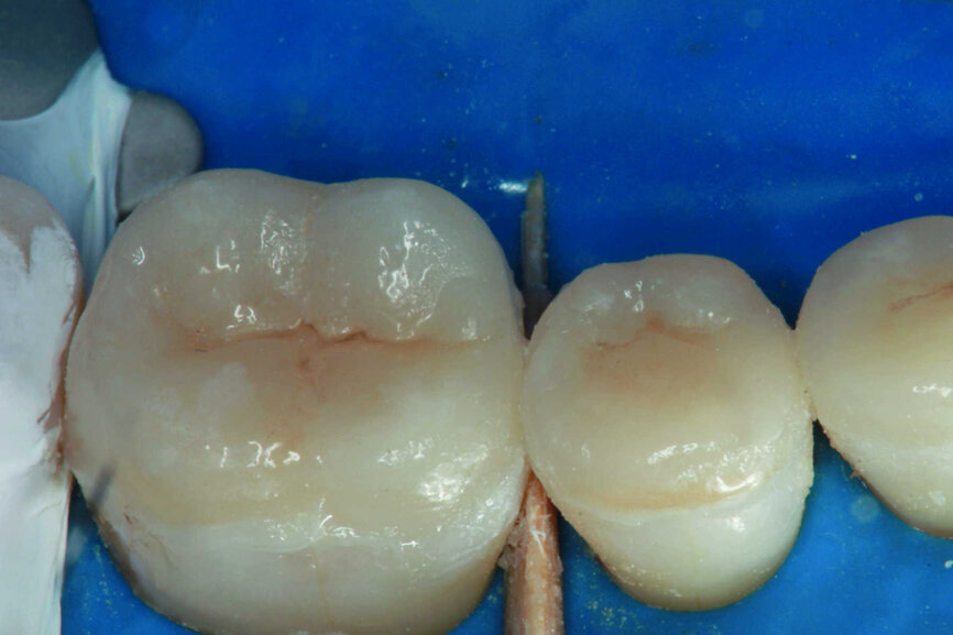 Fig.18