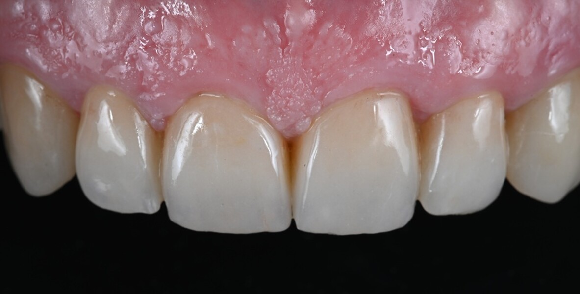 Fig. 11: Treatment outcome.