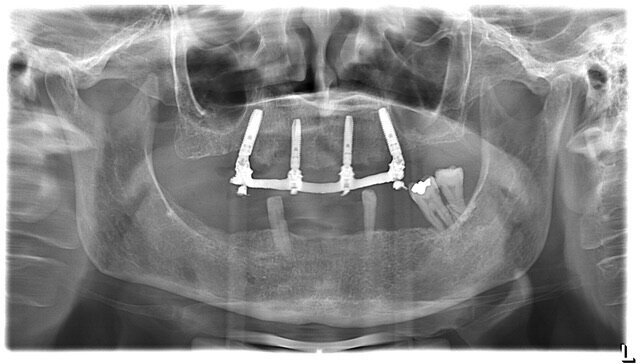 Fig. 41
