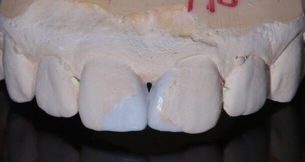FIG03