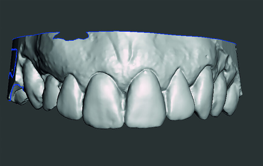 Fig. 7b