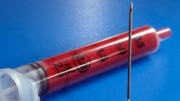 Platelet-rich plasma helps after extractions