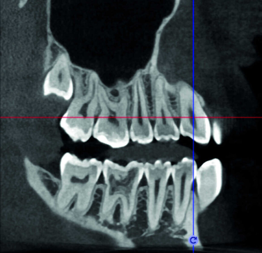 Figure 22
