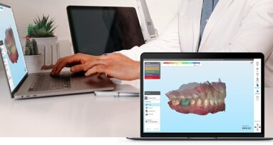 Align Technology presenta iTero Design Suite, la funzionalità di progettazione intuitiva per la stampa 3D in studio