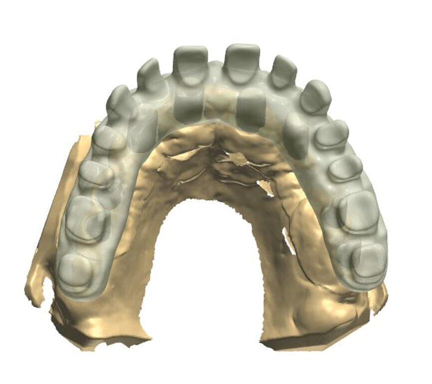Fig. 7: Project of the construction with transparency mode on.