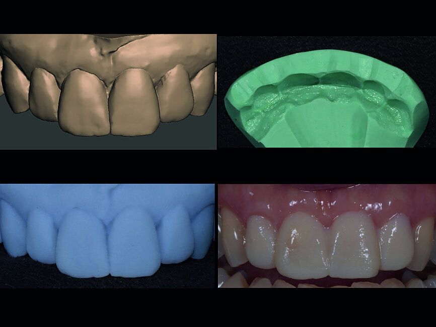 Fig. 9a, b, c, d
