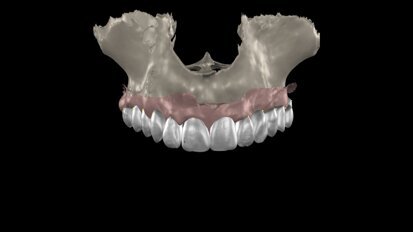 Transforming full-mouth rehabilitation: A case report on Smilecloud and digital workflows