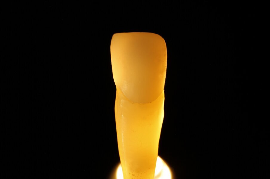 Fig. 12e: Light dynamics of natural teeth in direct and indirect light.