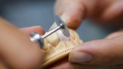 Analogue expertise in master dental laboratories remains indispensable