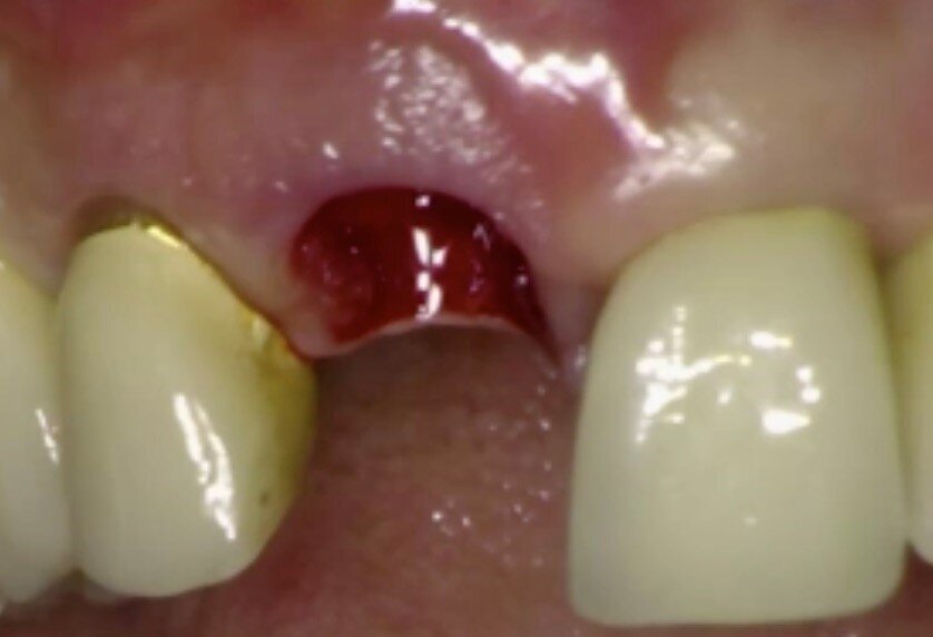 Fig. 8