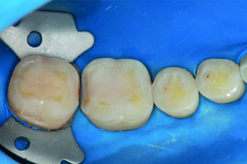Fig.12