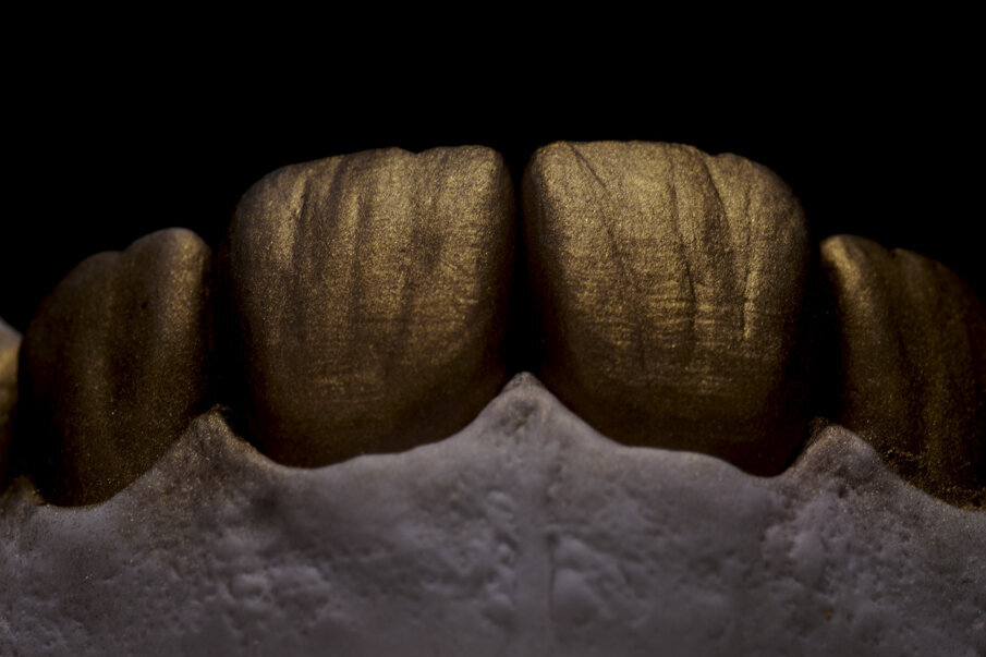 Fig. 30: External texture with gold powder and surface details.