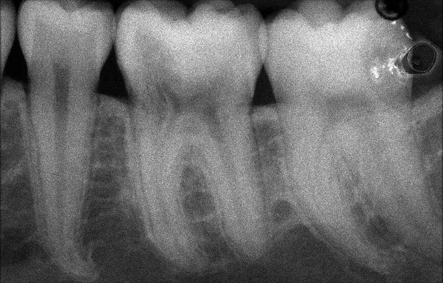 Figure 20