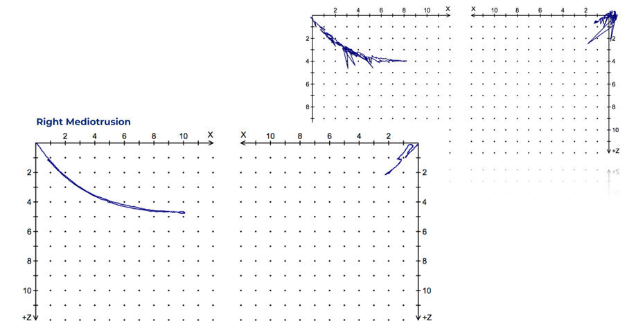 Fig. 44