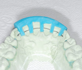 RETENTION TREATMENT