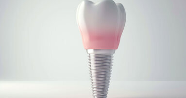 Neue S3-Leitlinie zum Thema Keramikimplantate