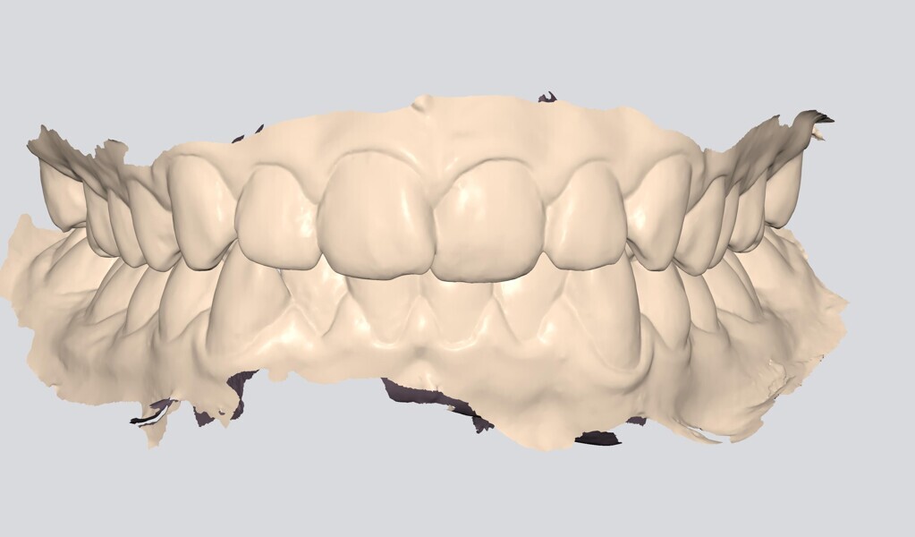 Fig. 9