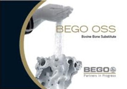 BEGO OSS
