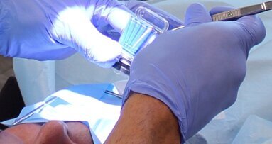 New device detects bacteria during root canal treatment
