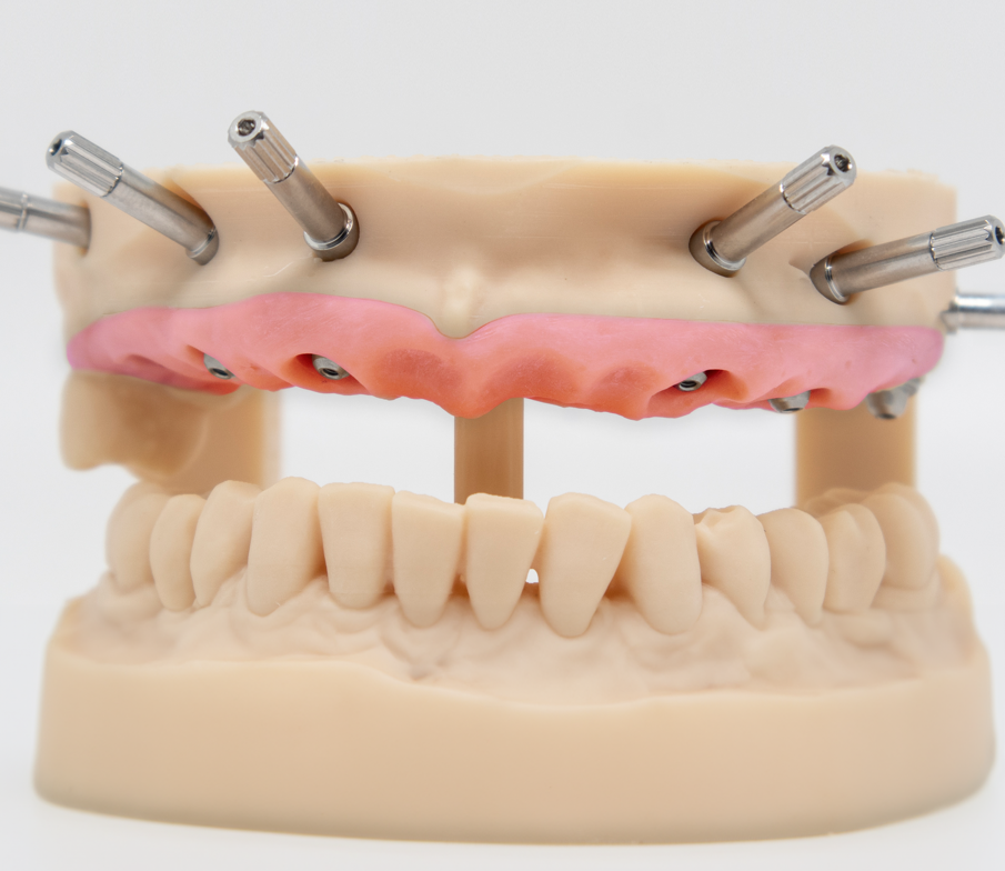 Fig. 14_Modello stampato con resina Dental Makers Pro Model e Stampante Dental Makers LB4K 2.0. Tutto il flusso è stato ottimizzato e validato per ottenere i migliori risultati clinico-tecnico possibili.