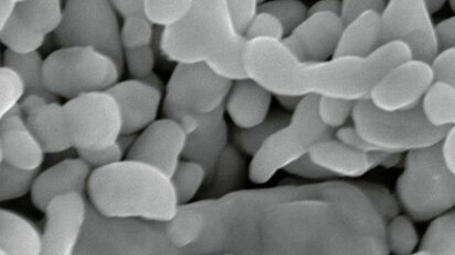 Silver nanoparticles in dentistry
