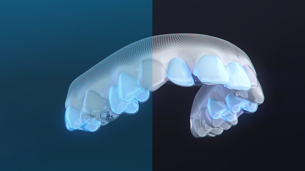 Align Technology predstavlja paket Invisalign Moderate, zdravljenje za korekcijo blage do zmerne malokluzije