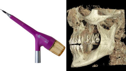 Parodontologie: Webinar thematisiert Prophylaxe und Diagnostik