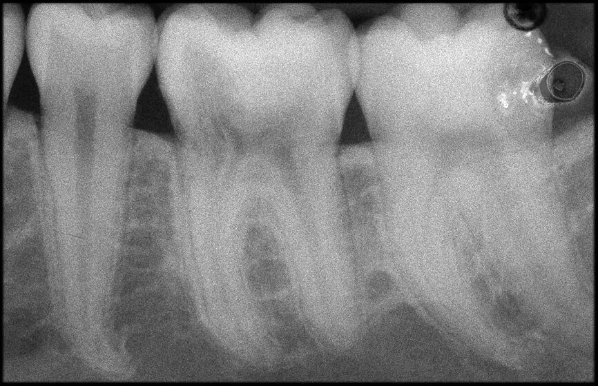 Fig. 20