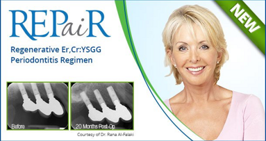 Láser contra la periodontitis