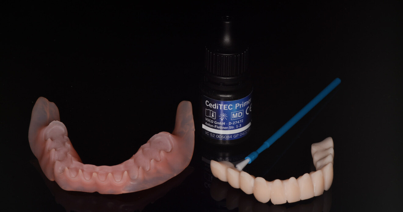 Fig. 8: Conditioning the denture bases and tooth segments with CediTEC Primer.