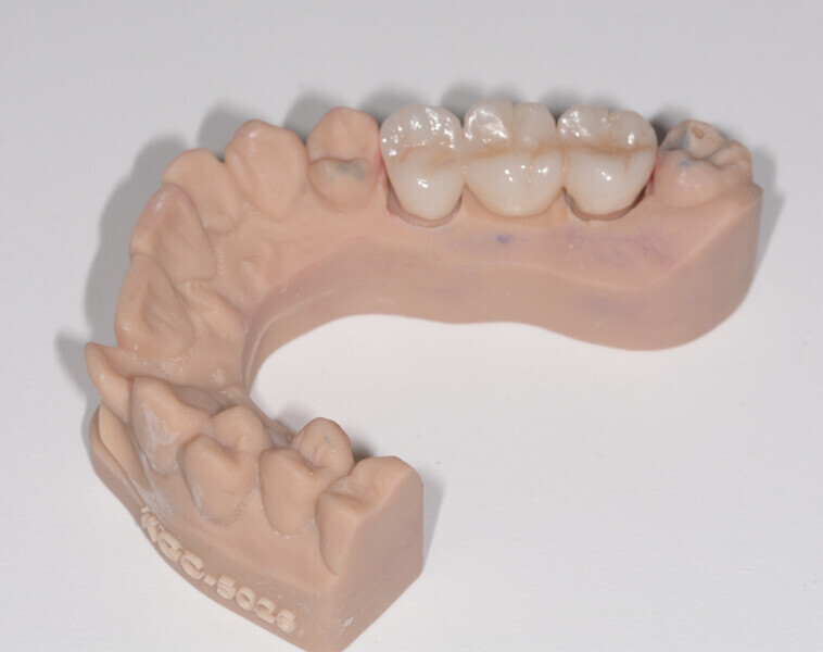 Fig. 4c